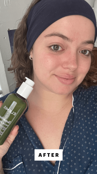 Hoffmann after applying the Elemis Superfood Facial Wash